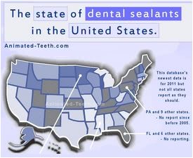 Snapshot picture of infographic: Dental Sealants in the USA.