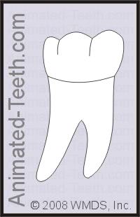Illustration of a mandibular (lower) molar.