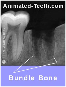 X-ray showing tooth socket bundle bone.