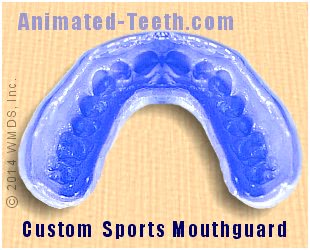 Link to Mouthguard Care section.