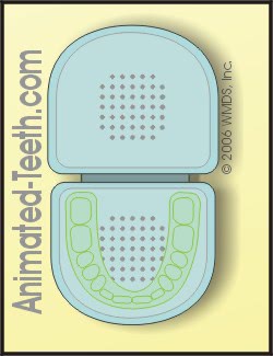 Link to Mouthguard Protection section.