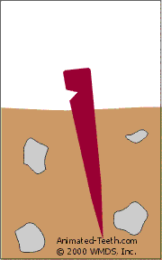Animation showing how rocking a tent stake back and forth enlarges its hole.