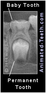 X-ray showing an early stage of permanent tooth formation and baby tooth exfoliation.