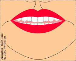 Animation showing the locations where cold sores form.