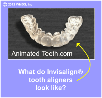 Sideshow explaining what Invisalign® tooth aligners look like.