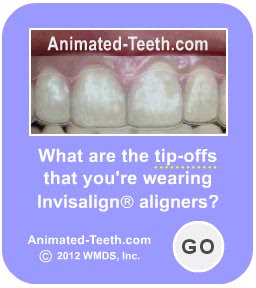 Graphic that suggests that speech problems can be a tip-off that you're wearing Invisalign®.