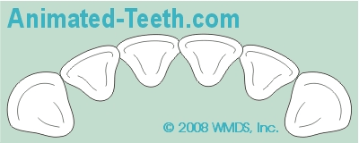 Animation showing how crowded teeth can be stripped (reduced in width) and then realigned.