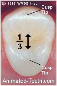 Graphic relating maximum filling size to tooth intercuspal distance.