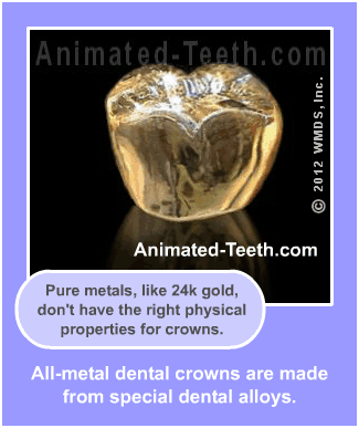 Slideshow explaining gold dental crowns.