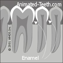 Animation showing the dentin portions of a tooth.