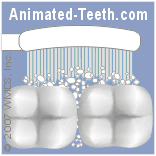 Animation illustrating the fluid-dynamics cleaning action of a Sonicare toothbrush.