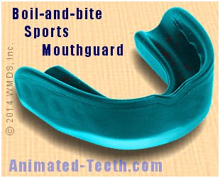 Picture of a boil-and-bite mouthguard, before customization.