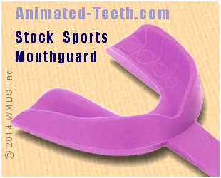 Picture of a stock athletic mouthguard.