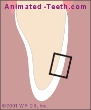 Animation showing how a natural tooth handles light.