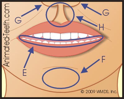 Graphic from 'Facial Anatomy' quiz, Part II.
