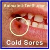 Cold Sore identification and stages.