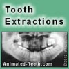 Tooth extraction healing time line.