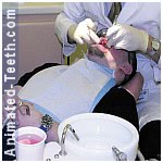 A dentist performing endodontic therapy.