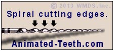 A closeup of the cutting edges of a root canal file.