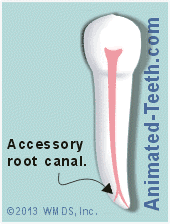 Animation showing lateral and accessory root canals.