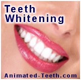 Topic teeth whitening.