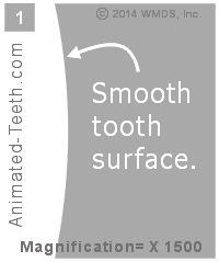 Animation showing how after acid etching the tooth's surface is very rough.
