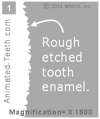 Animation showing how dental bonding locks onto the roughened enamel surface.