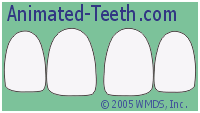 Animation showing how dental bonding can be used to close gaps between teeth.