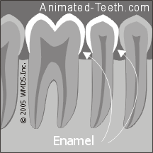 Animation showing the enamel vs. dentin portions of a tooth.