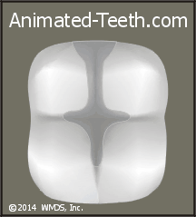 Animation demonstrating that a composite filling can often be smaller than an equivalent amalgam one.