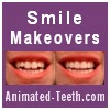 Logo for Animated-Teeth.com's Digital Smile Makeovers section that illustrates diastema closure.