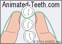 Illustration of how to wrap your floss around the side of a tooth.