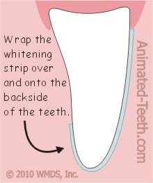 Fold the whitening strip (Whitestrips) onto the backside of the teeth.