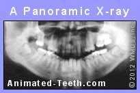 A panoramic dental x-ray.